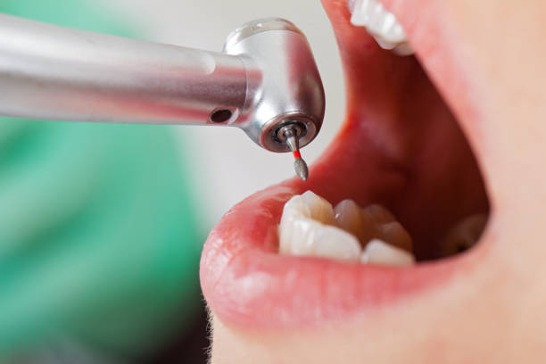 Best Dentist for Tooth Abscess  in Conrad, IA
